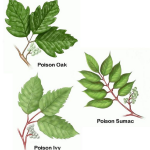 Summer Injuries MultiCare Indigo Urgent Care poison ivy